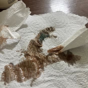 Son Kullanma Tarihi Geçmemiş Çikolatalı Sütte Küf Ve Sağlık Riski