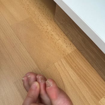 Ayakkabı Ayak Kesiyor Ve Değişim Talebi Reddedildi