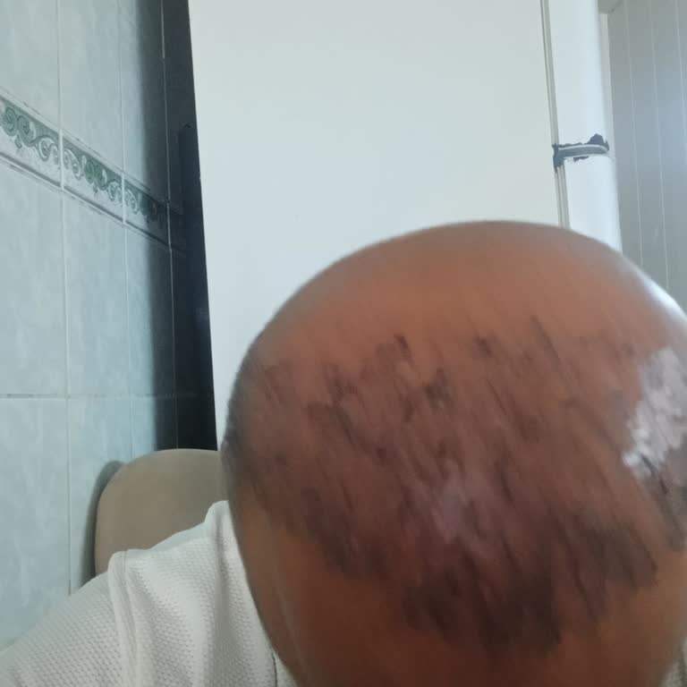 Estego Clinic İşlem Son Derece Özensiz Ve Acemiceydi