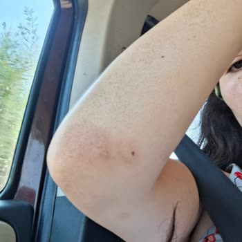 Safari Turunda Kaza Sonrası Tatilbudur’un İlgisiz Tutumu