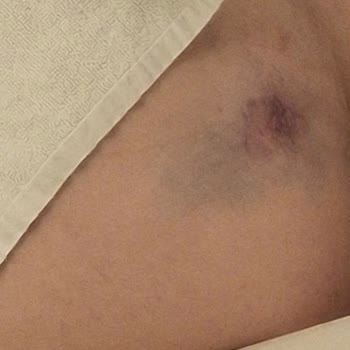 Safari Turunda Kaza Sonrası Tatilbudur’un İlgisiz Tutumu