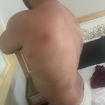 Kirli Oda, Sağlık Problemleri Ve Ücret İadesi İsteği