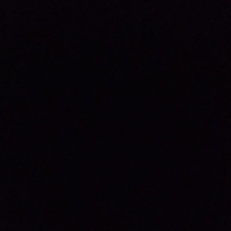 Ekspertiz Raporu Hatalı Ve Para Teslimi Aylardır Gecikiyor