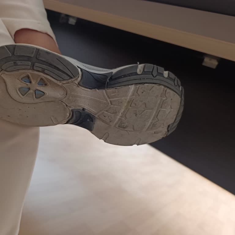 Ayakkabı Tabanı 4 Hafta İçinde Parçalanıp Ayrıldı