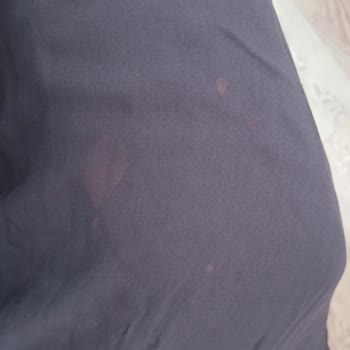 Fresh Scarf Şallarında Güneş Lekeleri Ve Kalite Sorunu