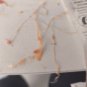 Köfte İçindeki Plastik Poşet Parçaları Sağlık Korkusuna Neden Oldu