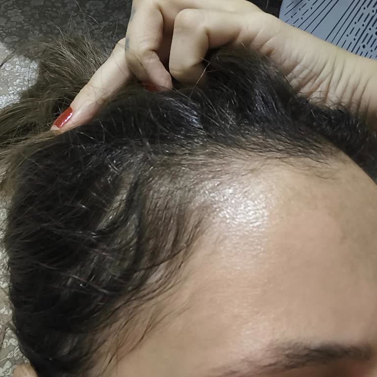 Saç Rengi İstediğim Gibi Değil, 7.000 TL İade Talebi