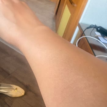 Tahta Kuruları Nedeniyle Tatilde Sağlık Felaketi