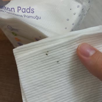 Bebek Temizleme Pamuklarında Küf Tespiti Ve Sağlık Endişesi