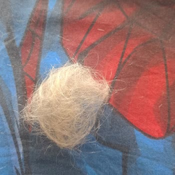 Emre'ce Hair Design Hem Maddi Kaybım Var Hem de Saçlarım Zarar Gördü