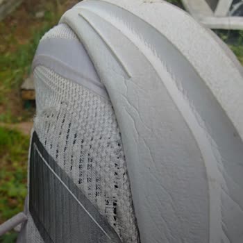 Deforme Olan Adidas Ayakkabıda Kullanıcı Hatası İddiası Ve Açıklama Talebi
