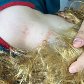 Schwarzkopf Saç Boyasında Yanma, Yara Ve Renk Uyuşmazlığı