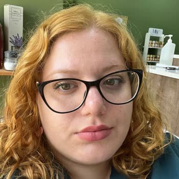 Schwarzkopf Saç Boyasında Yanma, Yara Ve Renk Uyuşmazlığı