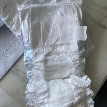 Kim Marketten Aldığım Molfix 5 Numaralı Bebek Bezinde Yan Çırtları Açık Ve Tutmuyor