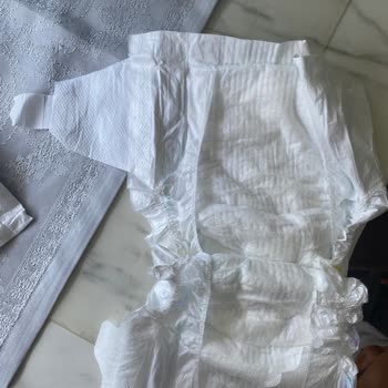 Kim Marketten Aldığım Molfix 5 Numaralı Bebek Bezinde Yan Çırtları Açık Ve Tutmuyor