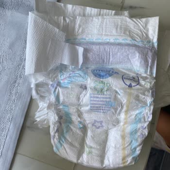 Kim Marketten Aldığım Molfix 5 Numaralı Bebek Bezinde Yan Çırtları Açık Ve Tutmuyor