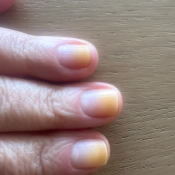Pastel Kırmızı Oje Tırnaklarda Kalıcı Kına Lekesi Ve Sağlık Endişesi