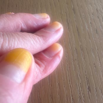 Pastel Kırmızı Oje Tırnaklarda Kalıcı Kına Lekesi Ve Sağlık Endişesi