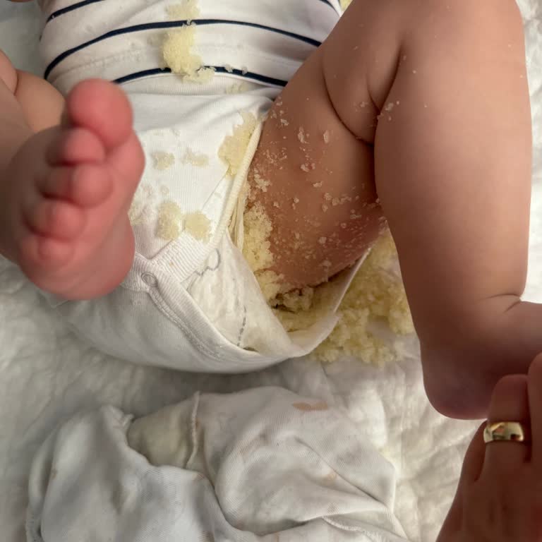 Prima Premium Care Bebek Bezinde Jel Kristallerinin Patlaması Sağlık Tehlikesi