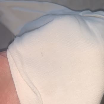 Esteban’dan Gelen Küflü Ve Yırtık Bluzlar İçin Tam İade Talebi