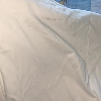 Esteban’dan Gelen Küflü Ve Yırtık Bluzlar İçin Tam İade Talebi