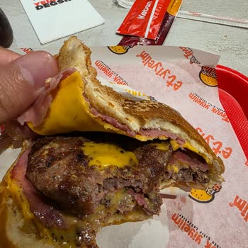 Alerji Uyarısına Rağmen Soğanlı Burger, Soğuk Ve Kalitesiz Sunum