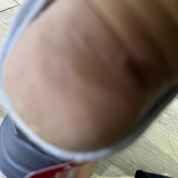 Ayakkabının Topuk Bölümü Ayağımı Yara Açtı, İade Reddedildi Ve Ürün İmha Edilecek