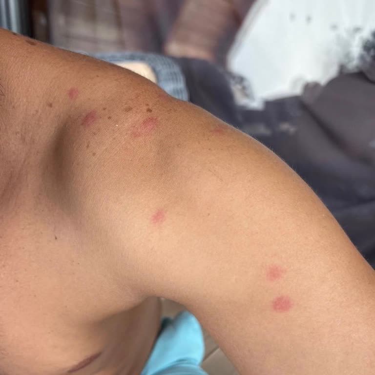 Hijyen Ve Tahtakurusu Sorunu Nedeniyle Erken Çıkış Ve İade Talebi