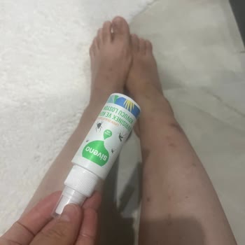Siveno Sivrisinek Kovucu Hiç Etkili Değildi Ve Bacaklarıma İz Bıraktı