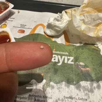 Hamburgerde Sert Beyaz Cisim Ve Hijyen Sorunu