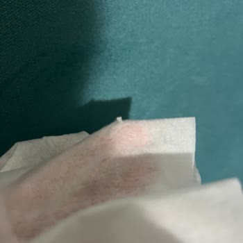 Yeni Doğan Bebek İçin Satın Alınan Islak Mendilde Keskin Parça Ve Cilt Yaralanması Riski