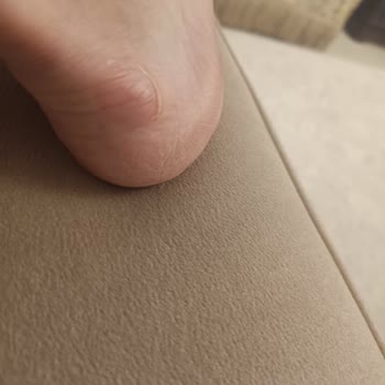 Sağ Ayak Topuğunda Su Toplanması Ve Vurması, Değişim Reddi