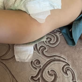 Yapışkan Sürekli Kopuyor, Ürün Dayanıksız Ve Mağduriyet Yaratıyor