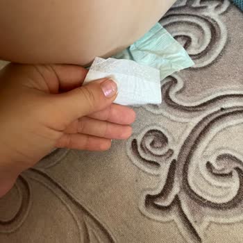 Yapışkan Sürekli Kopuyor, Ürün Dayanıksız Ve Mağduriyet Yaratıyor