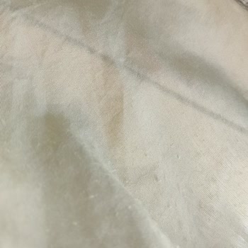 Ürün Kalitesi Sorunlu, İade Talebim Cevapsız Kaldı