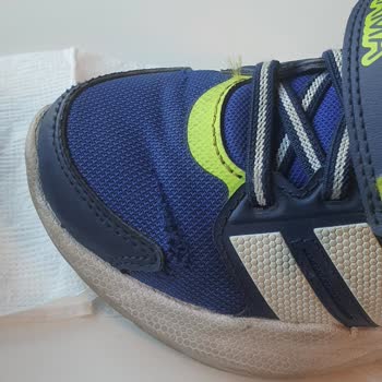 Adidas Çocuk Ayakkabısında 3 Ayda Tekstil Bozulması Ve Kalite Sorunu