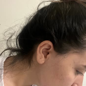 İlan Edilen 6.500 TL Fiyatı Aşan Ücret Ve Eksik Ombre Sonucu