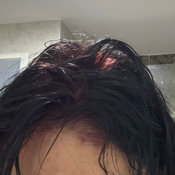 Ametist Mor Saç Boyası Yanıltıcı Renk Ve Güven Kırılması