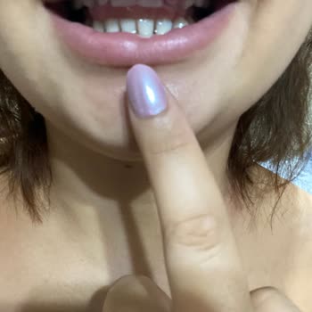 Lip Dolgusunda Etki Yok, Topaklanma Ve İade Talebi