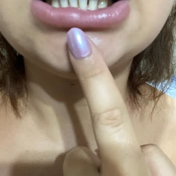 Lip Dolgusunda Etki Yok, Topaklanma Ve İade Talebi