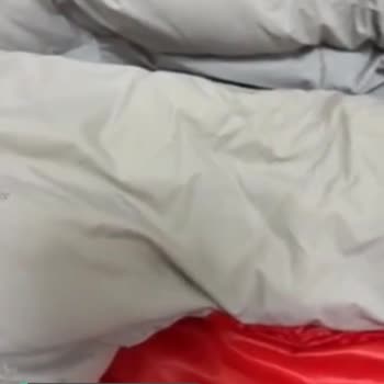 Lufian Mont Yaka Lekesi Çıkmıyor