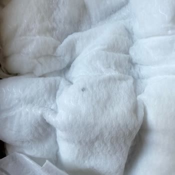 Bebek Bezinde Sert Yabancı Cisim Tespiti
