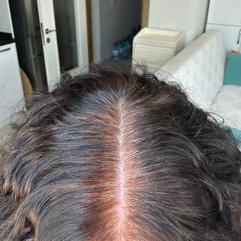 Subo Care Hem Zamanımdan Hem De Ödediğim Ücret Nedeniyle Maddi Olarak Mağdur Oldum
