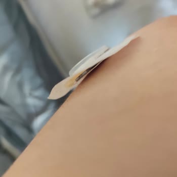 GS1 Sensörlerinde Sürekli Yapışma Sorunu Ve Değişim İsteği