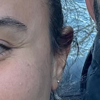 Neu Güzellik Bağcılar’da İşlem Sonrası Leke Ve Hakaret İçeren Personel Tutumu