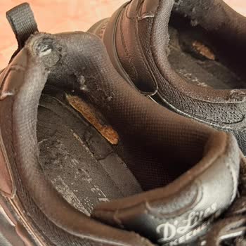Kısa Sürede Deforme Olan Skechers Ayakkabı Nedeniyle Ağır Sağlık Sorunu Ve İade Talebi
