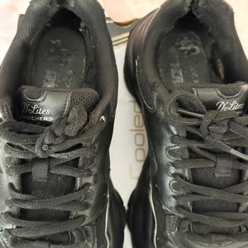 Kısa Sürede Deforme Olan Skechers Ayakkabı Nedeniyle Ağır Sağlık Sorunu Ve İade Talebi