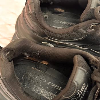 Kısa Sürede Deforme Olan Skechers Ayakkabı Nedeniyle Ağır Sağlık Sorunu Ve İade Talebi