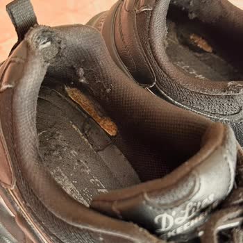 Kısa Sürede Deforme Olan Skechers Ayakkabı Nedeniyle Ağır Sağlık Sorunu Ve İade Talebi