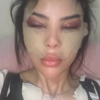 Dr. Alper Tuncel Estetik Operasyon Sonrası Yaşadığım Süreç Ve Yeniden Ücret Talebi